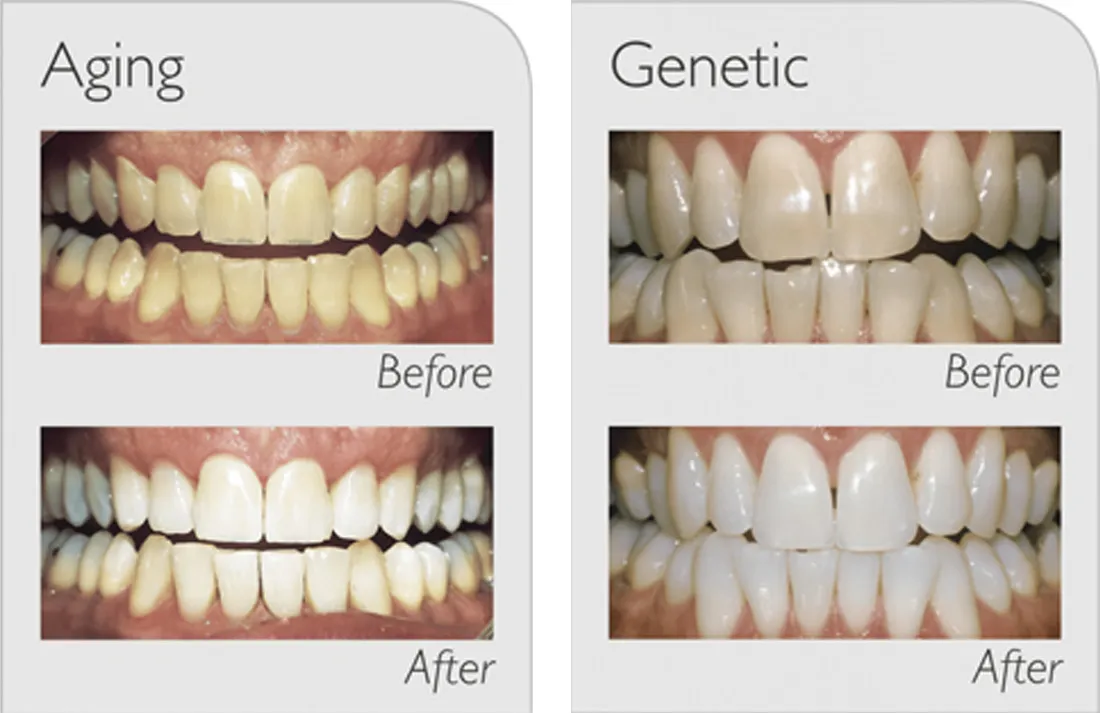 24473 dentist consultation