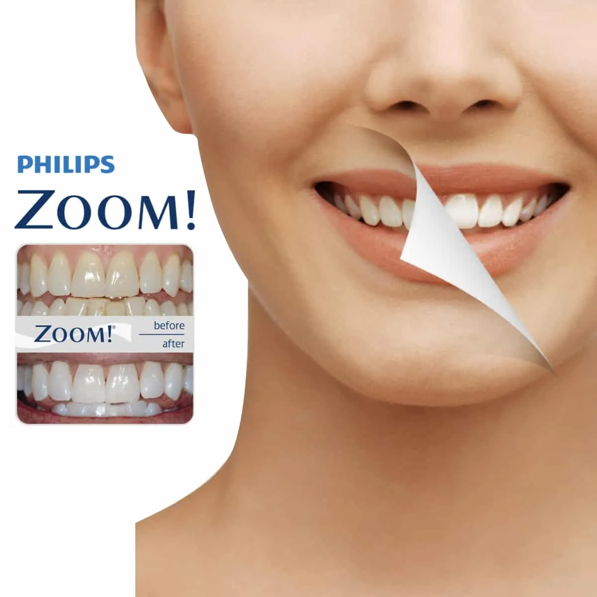 24473 teeth cleaning