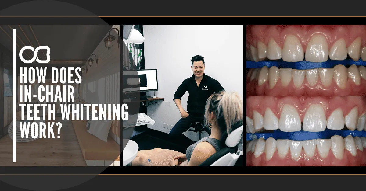 /img/24473-teeth-whitening-maintenance.webp