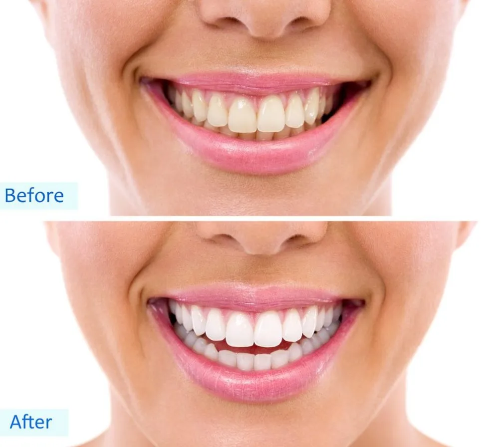 24483 dentin enamel interaction