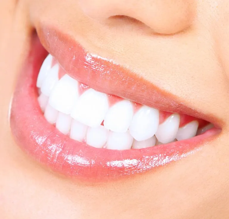 24614 at home whitening