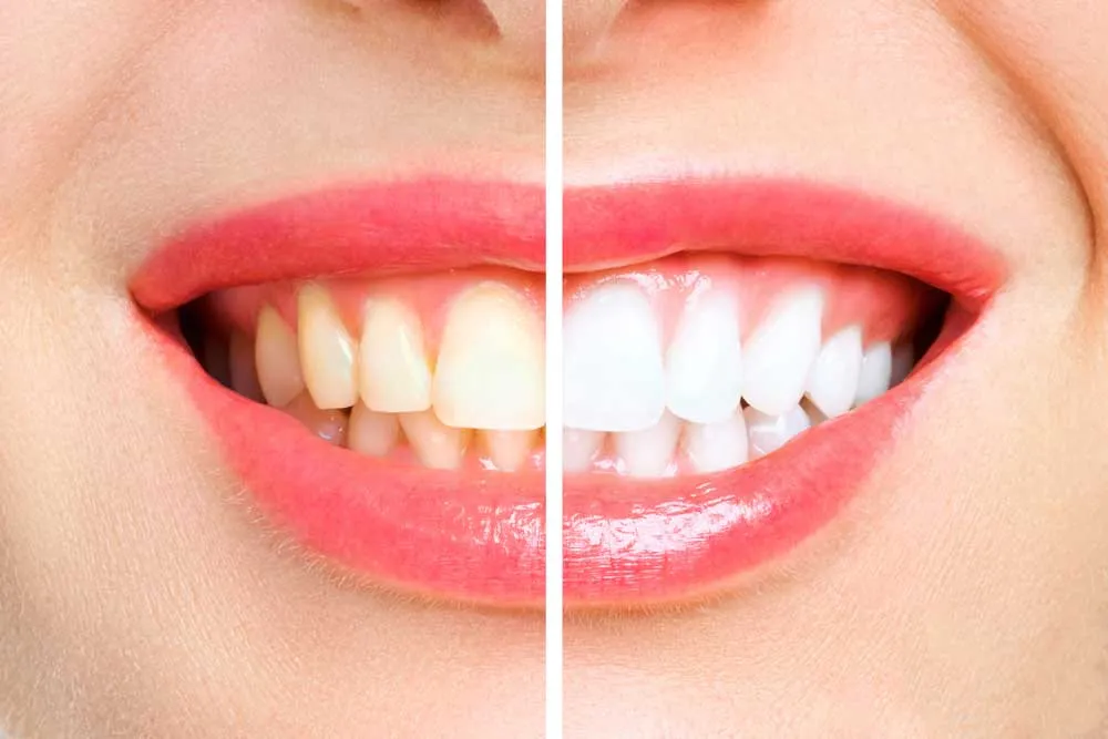 24614 land o lakes dentist