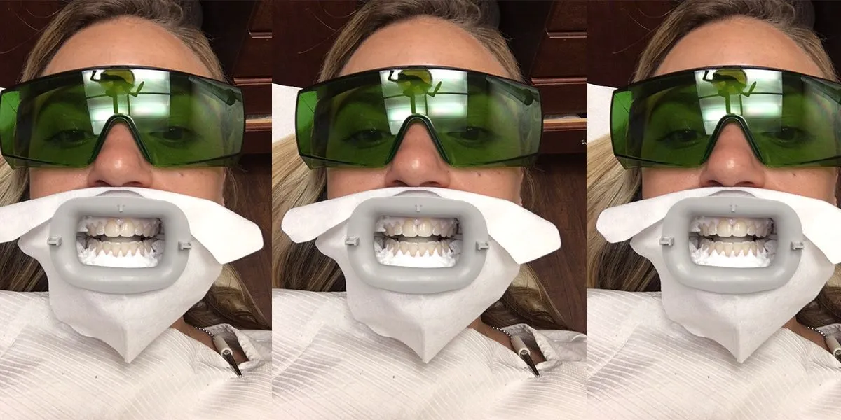 24623 professional whitening