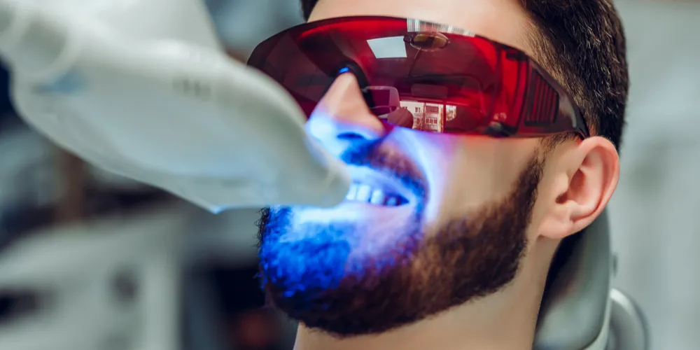 24709 professional teeth whitening
